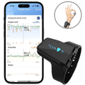 wellue 12-lead holter monitor with ai analysis