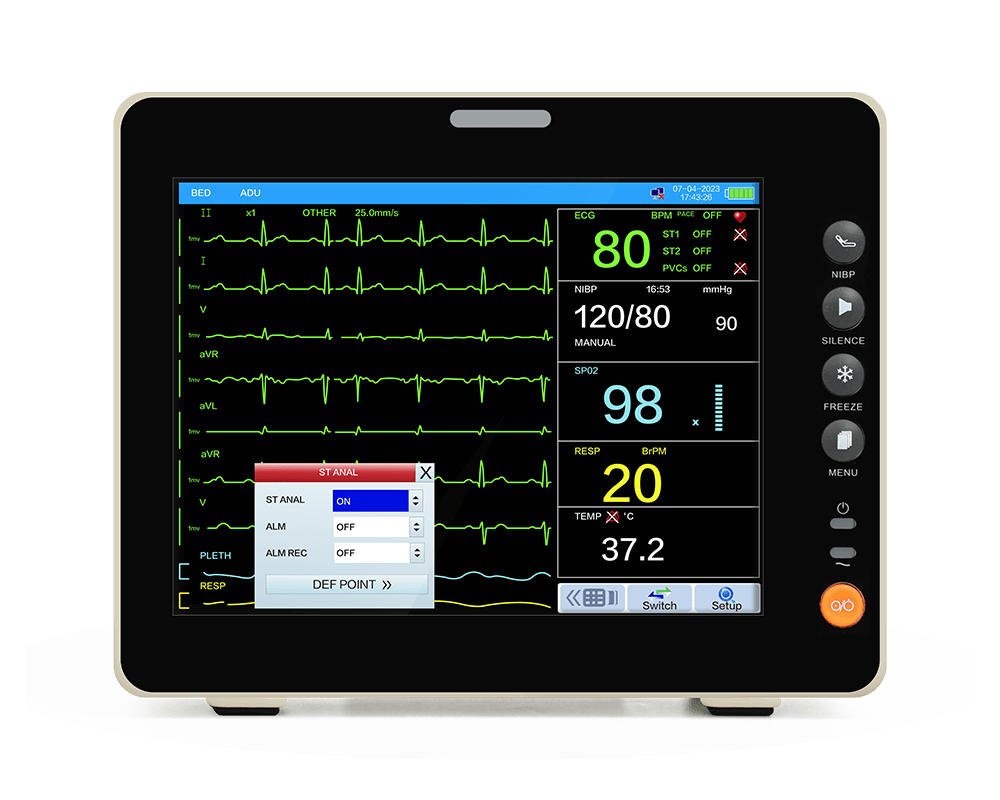 Monitor de paciente portátil EtCO2 con análisis st