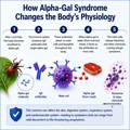 alpha-gal-syndrome-physiological-changes