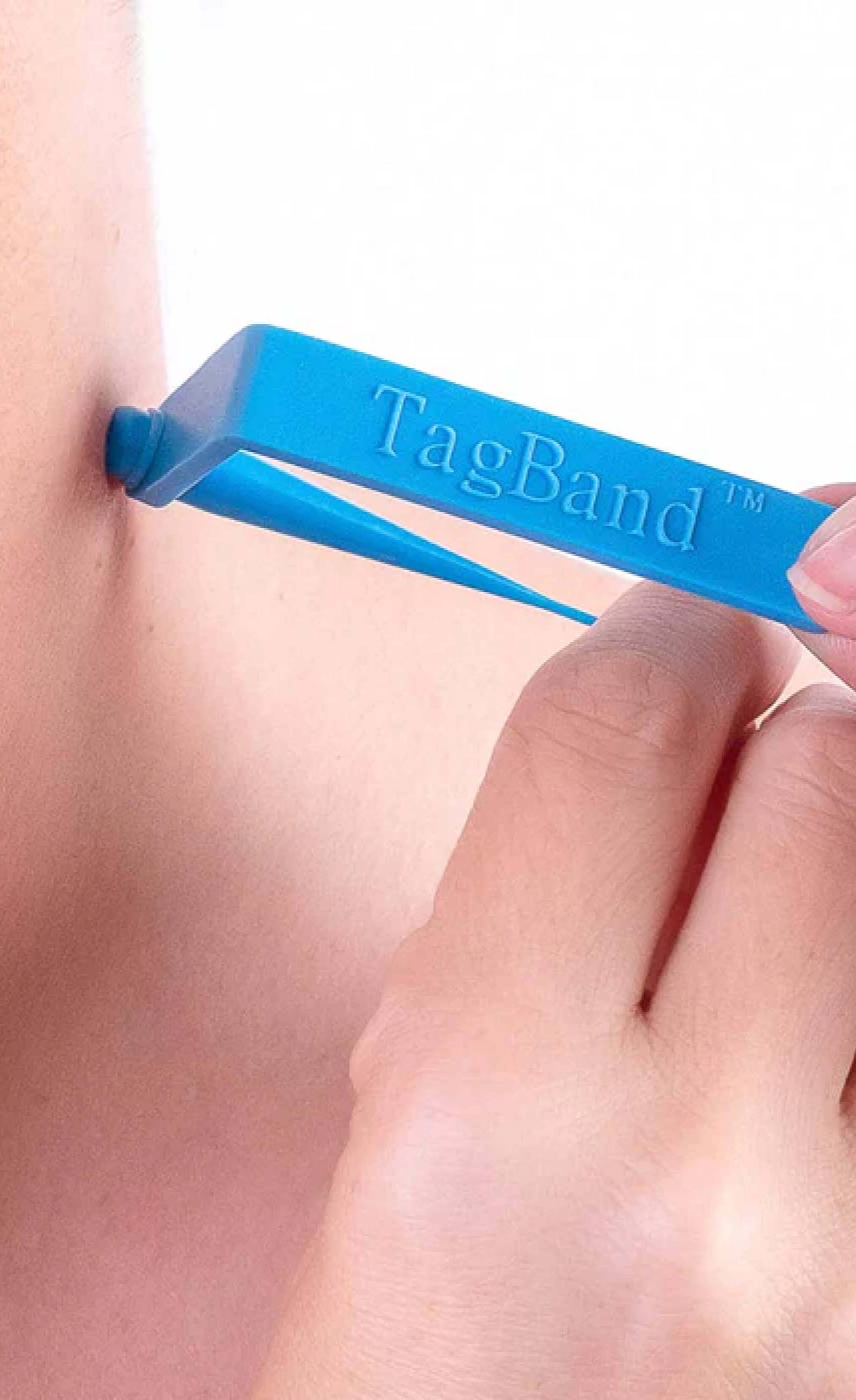 TagBand Skin Tag Removal Kit