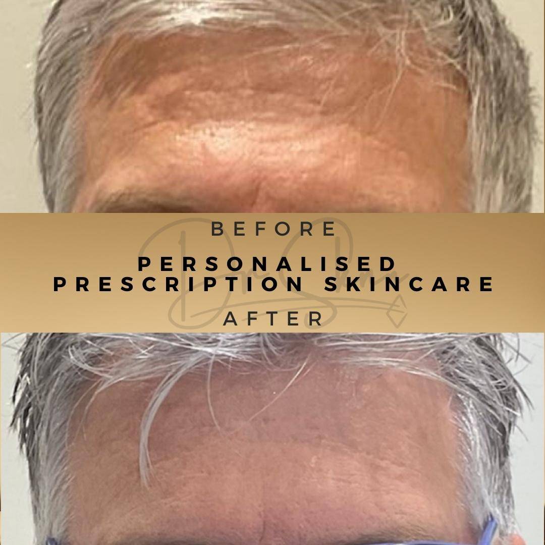 Personalised Medical Grade Skincare Wilmslow Before & After Dr Sknn