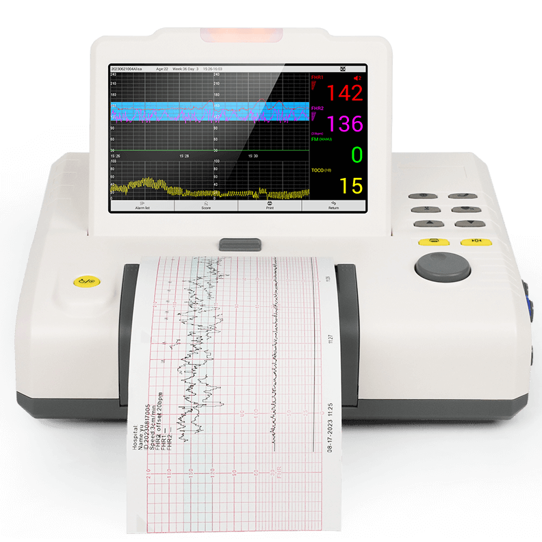 fetal monitor with built-in thermal printer