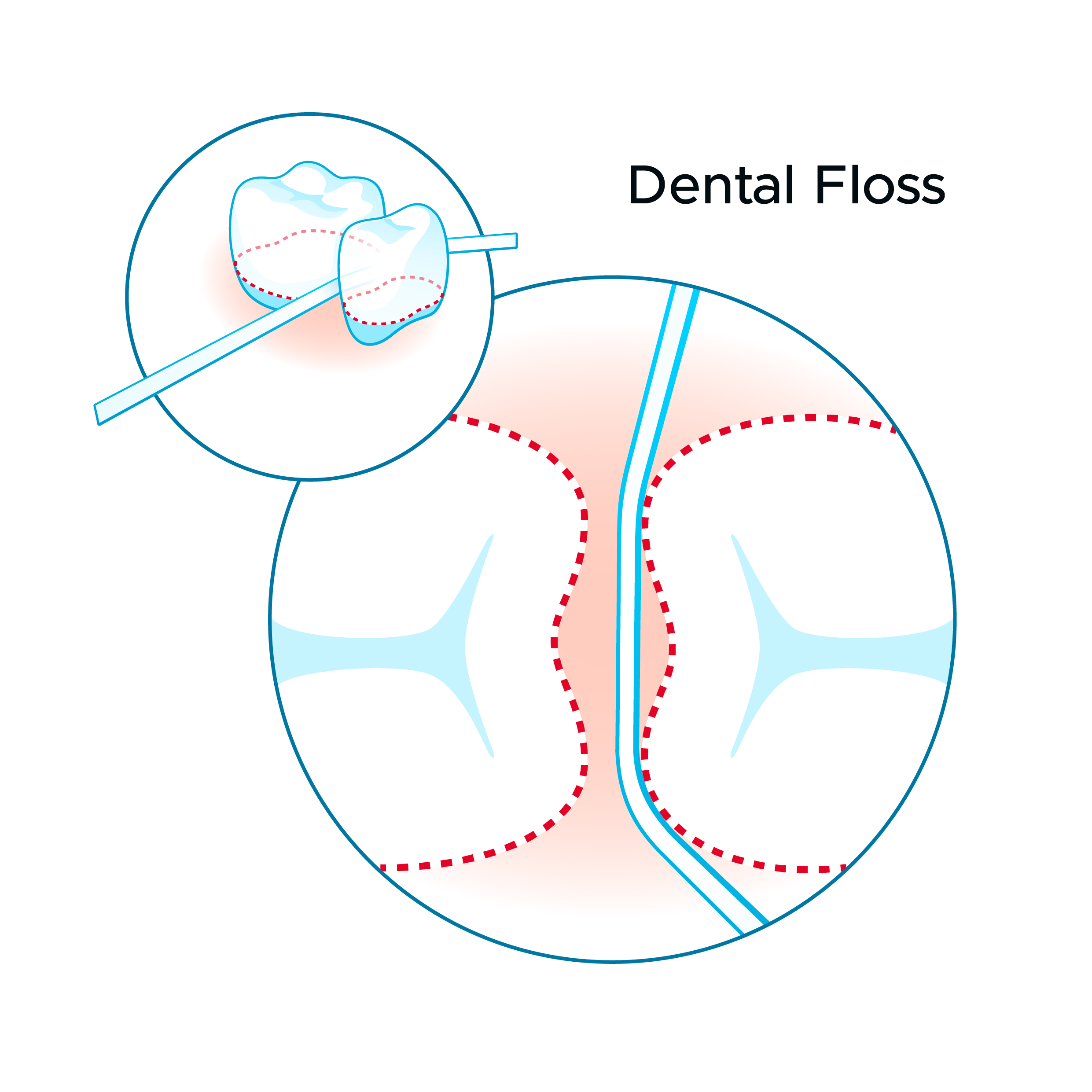 Illustration showing how dental floss fits between teeth