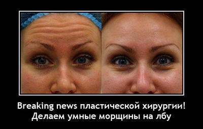 Breaking news пластической хирургии! Делаем умные морщины на лбу.
