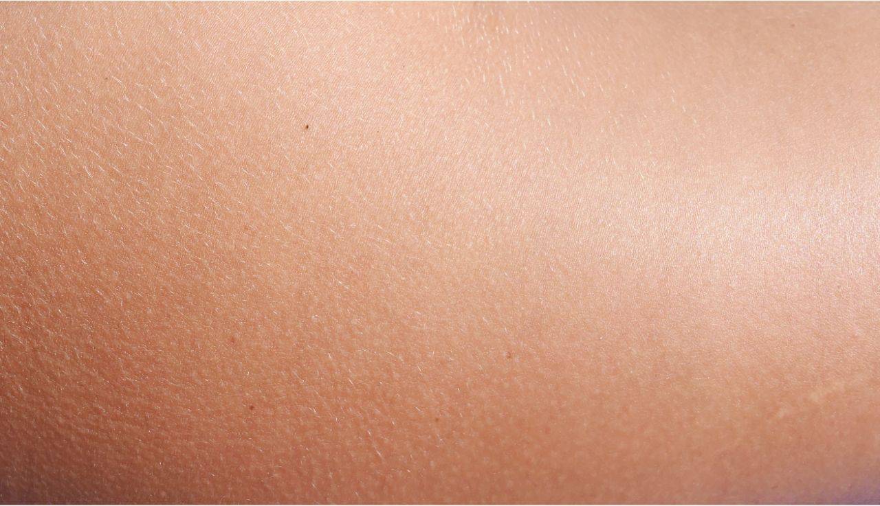 Hauttyp: Normale Haut – Beitragsbild