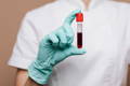 Can an MTHFR Gene Mutation Cause Anemia