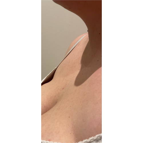 Hydrachest Before