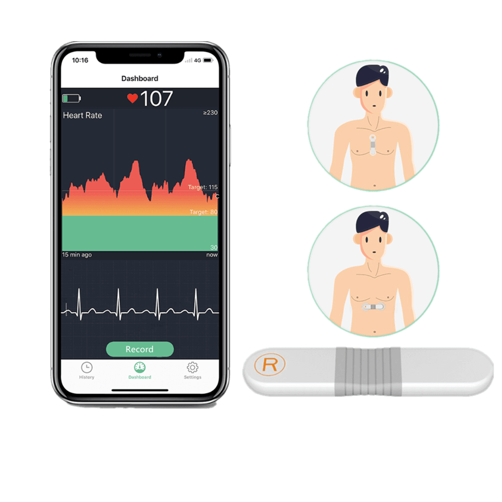 The differences between ECG heart rate monitors and optical heart