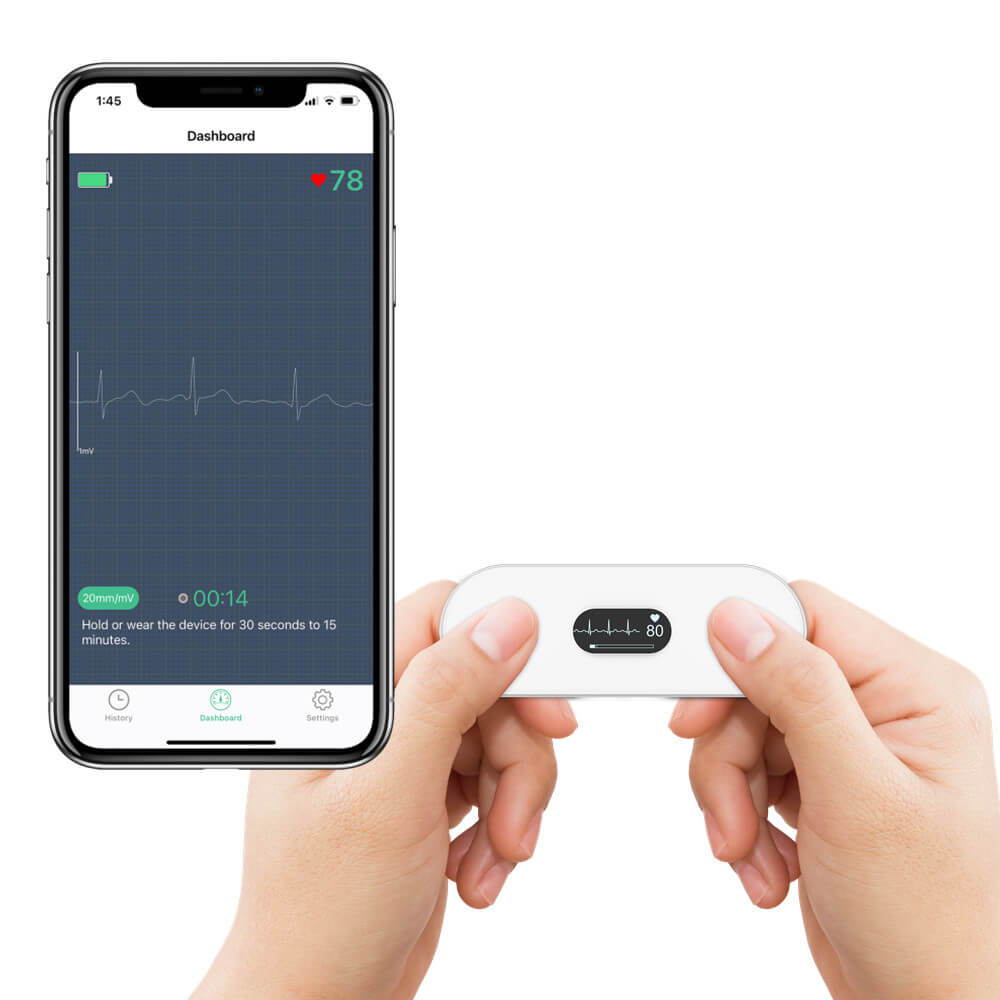 Monitor de EKG portátil Wellue con pantalla OLED