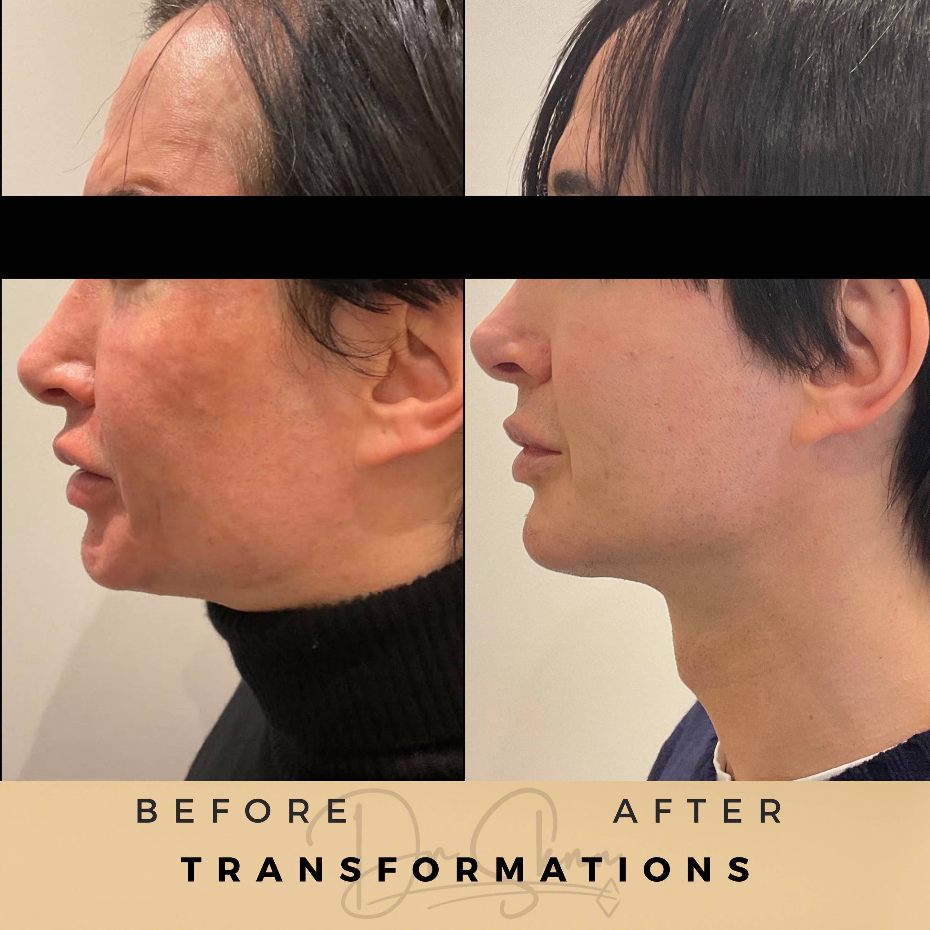Transformations - Dr Sknn before and after