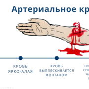 Виды кровотечений — Шаг 2 — Stepik