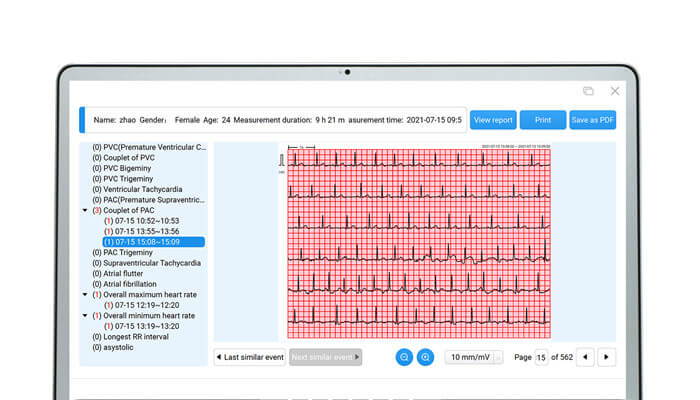 download and share the ECG reports and waveforms