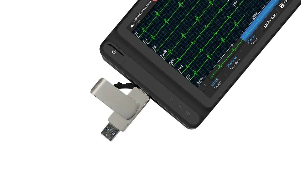 12-lead ECG tablet provides a USB type-c falsh drive for data storage and printing.
