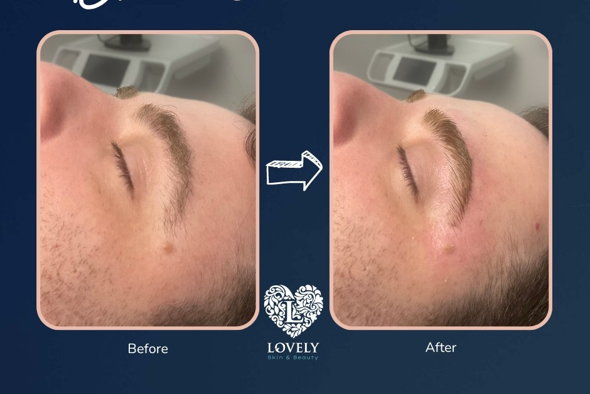 Lovely Skin and Beauty - MAGNIFIQUE Lash & Brow Package