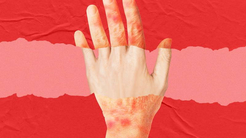 Image may contain: Body Part, Hand, Person, Wrist, Skin, and Finger