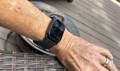 Customer photo of the Wellue blood pressure watch worn during daily use