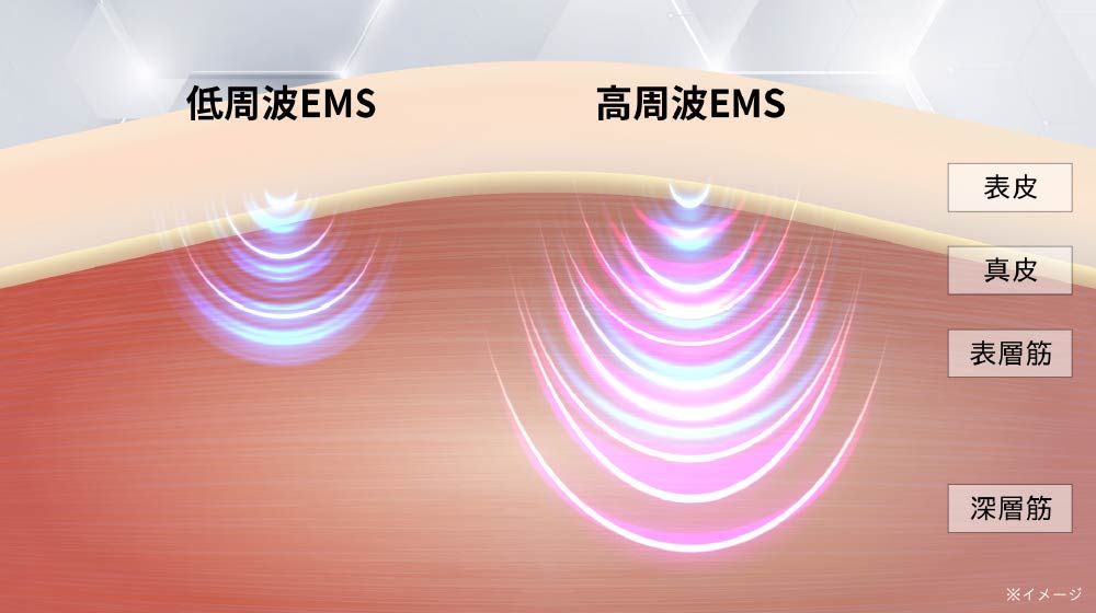 EMS