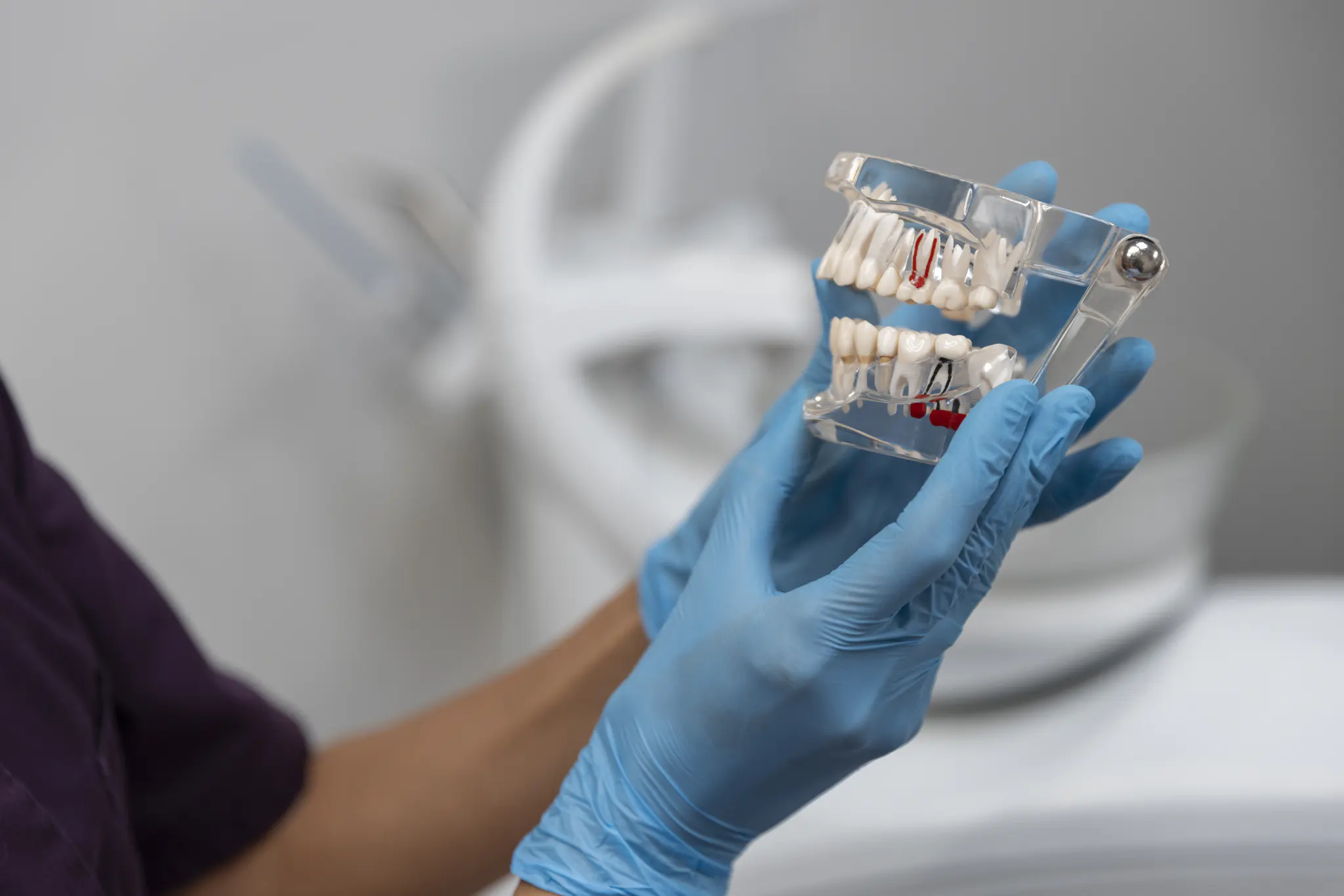 Zahnimplantate - Moderne Implantat-Systeme von renommierten und zertifizierten Herstellern