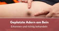 geplatzte ader am bein