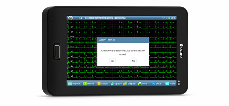 جهاز تخطيط القلب ذو 12 سلكًا مع الكشف التلقائي عن عدم انتظام ضربات القلب
