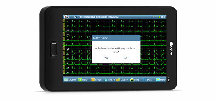 Máquina de ECG de 12 derivaciones con detección automática de arritmias