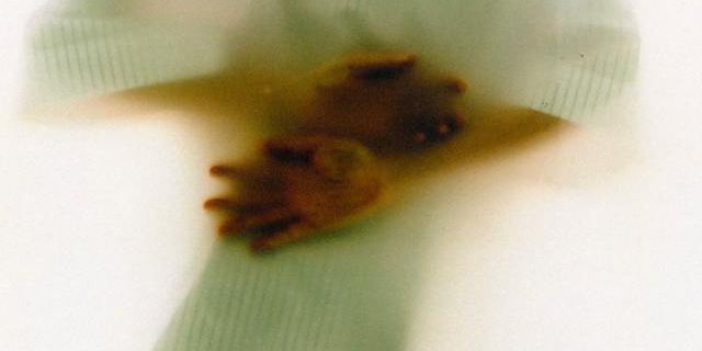 list image