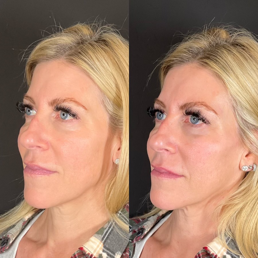 Transformation image 3