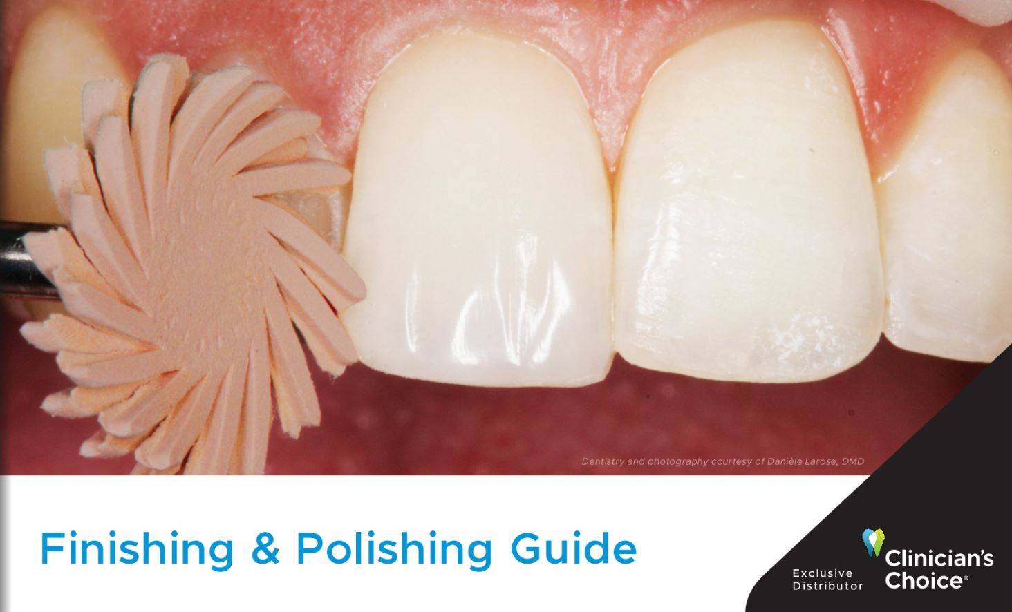 Clinician's Choice: Finishing and Polishing Guide