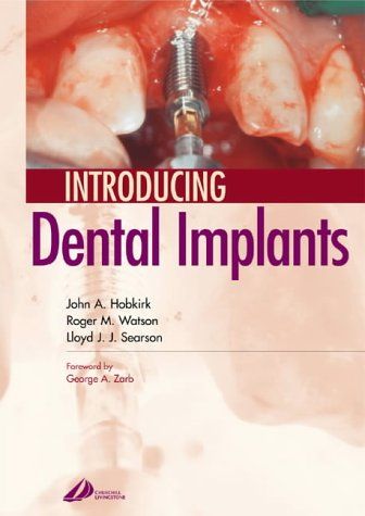 Introduction aux Implants Dentaires