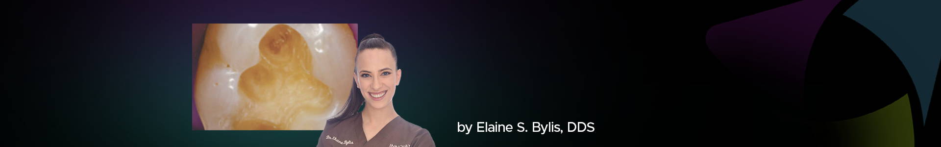 blog banner featuring Dr Elaine Bylis and a clinical case in the back