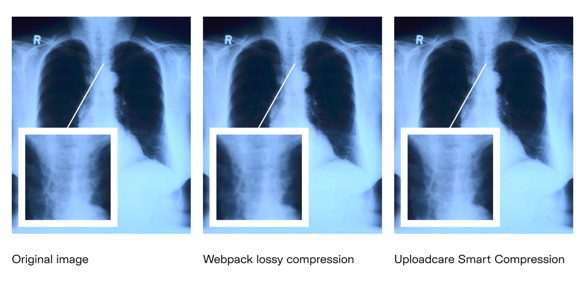 Webpack utilizes lossy compression that throws away some information. But there are cases when you certainly don’t want to miss anything A comparison of lossy compression by webpack and smart compression by Uploadcare