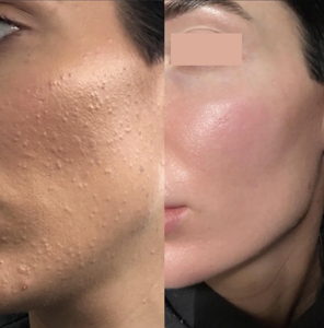 Haus of Dermal $10 Voucher