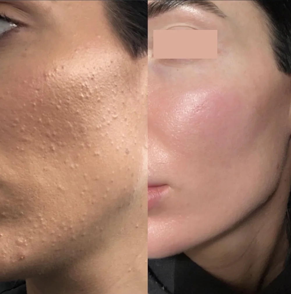 Haus of Dermal Voucher