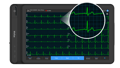 See waveforms and ECG clearly on the display of Wellue smart tablet-based ECG.