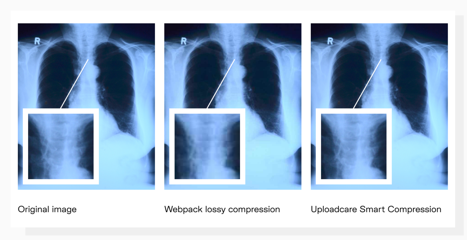 Webpack image compression vs Uploadcare compression