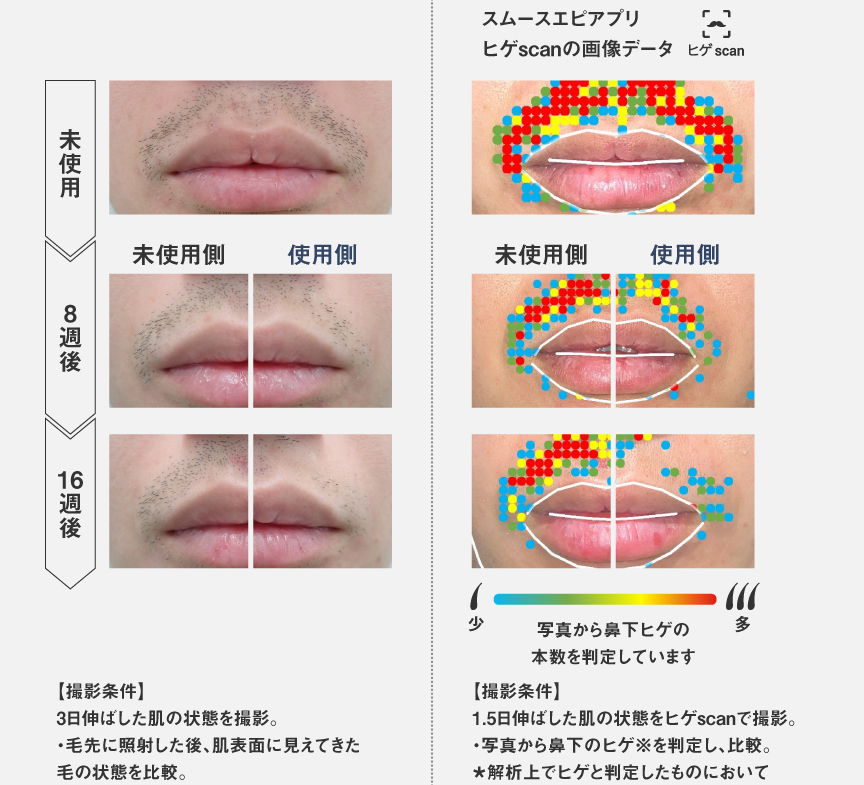 ヒゲ