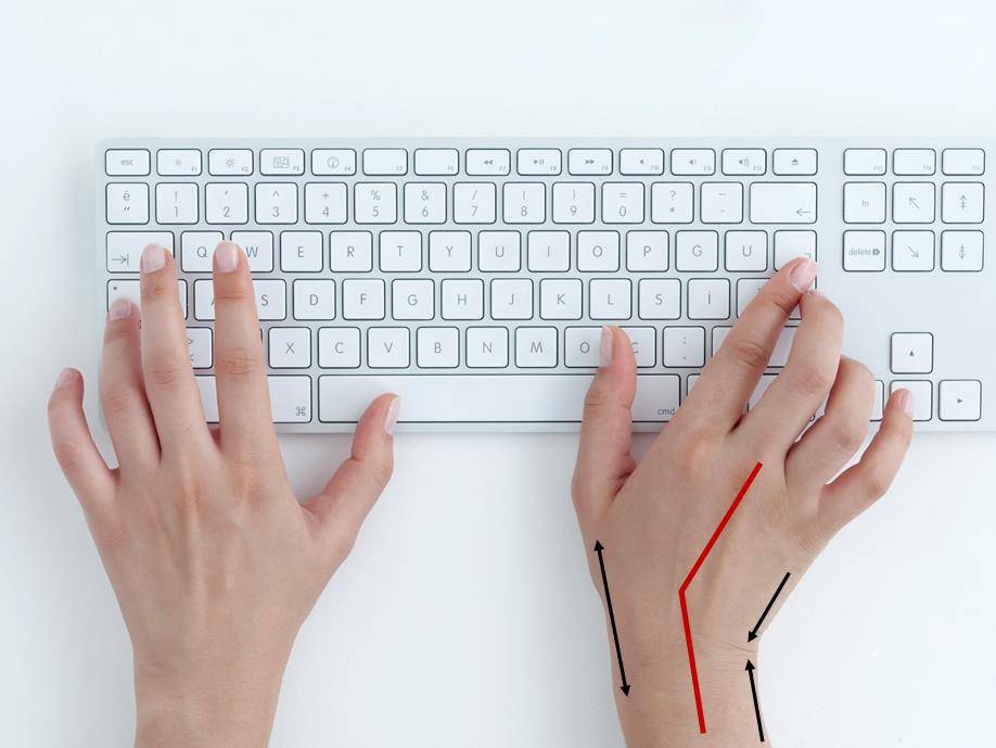 wrist pain carpal tunnel syndrome keyboard