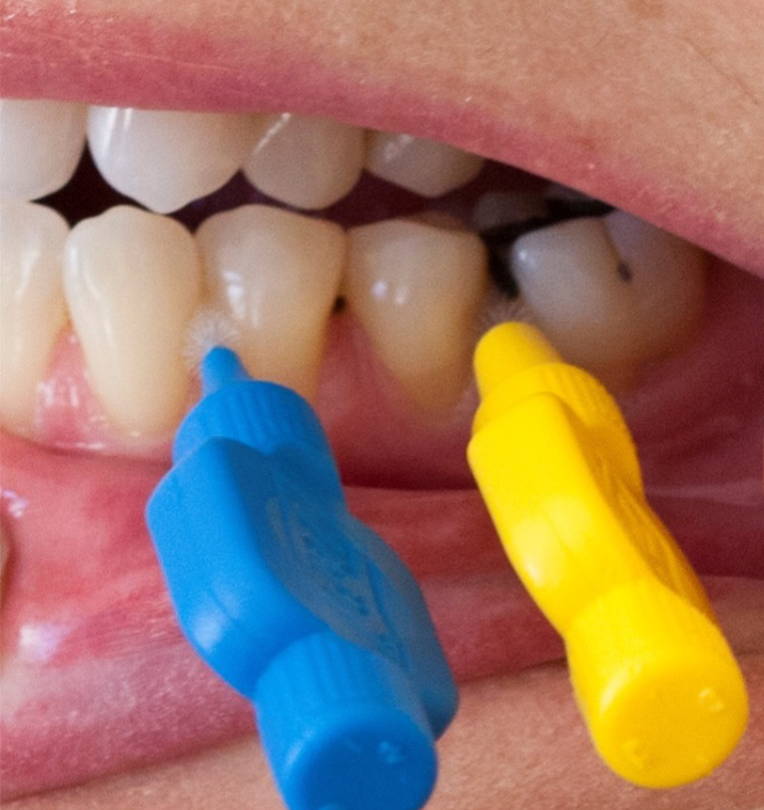 blue and yellow interdental brushes inserted between bicuspids