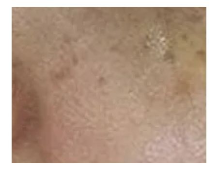 Sun Spots