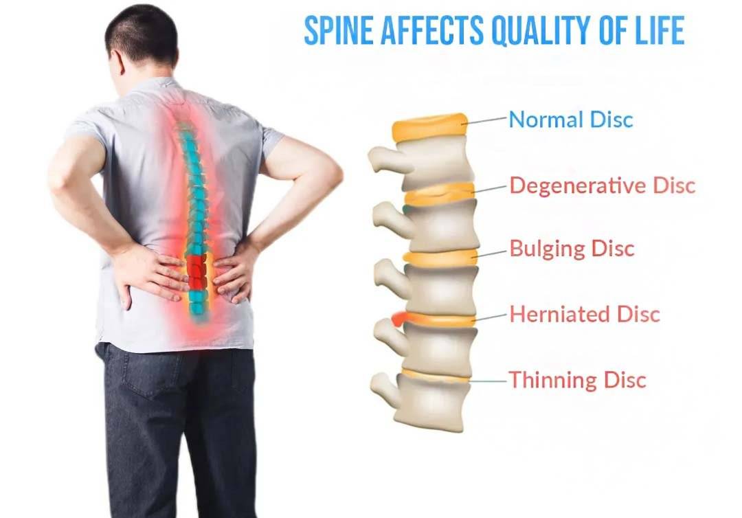 lumbarposture, decompression belt, lumbar decompression belt, lumbarposture.com