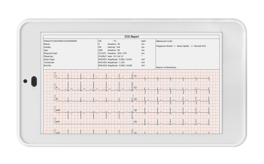 Mit dem Taschen-EKG-Gerät von Wellue mit 12 Ableitungen können Benutzer EKG-Berichte exportieren und drucken