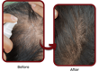 Before and After image of a person using NANOSKIN Hair Tonic