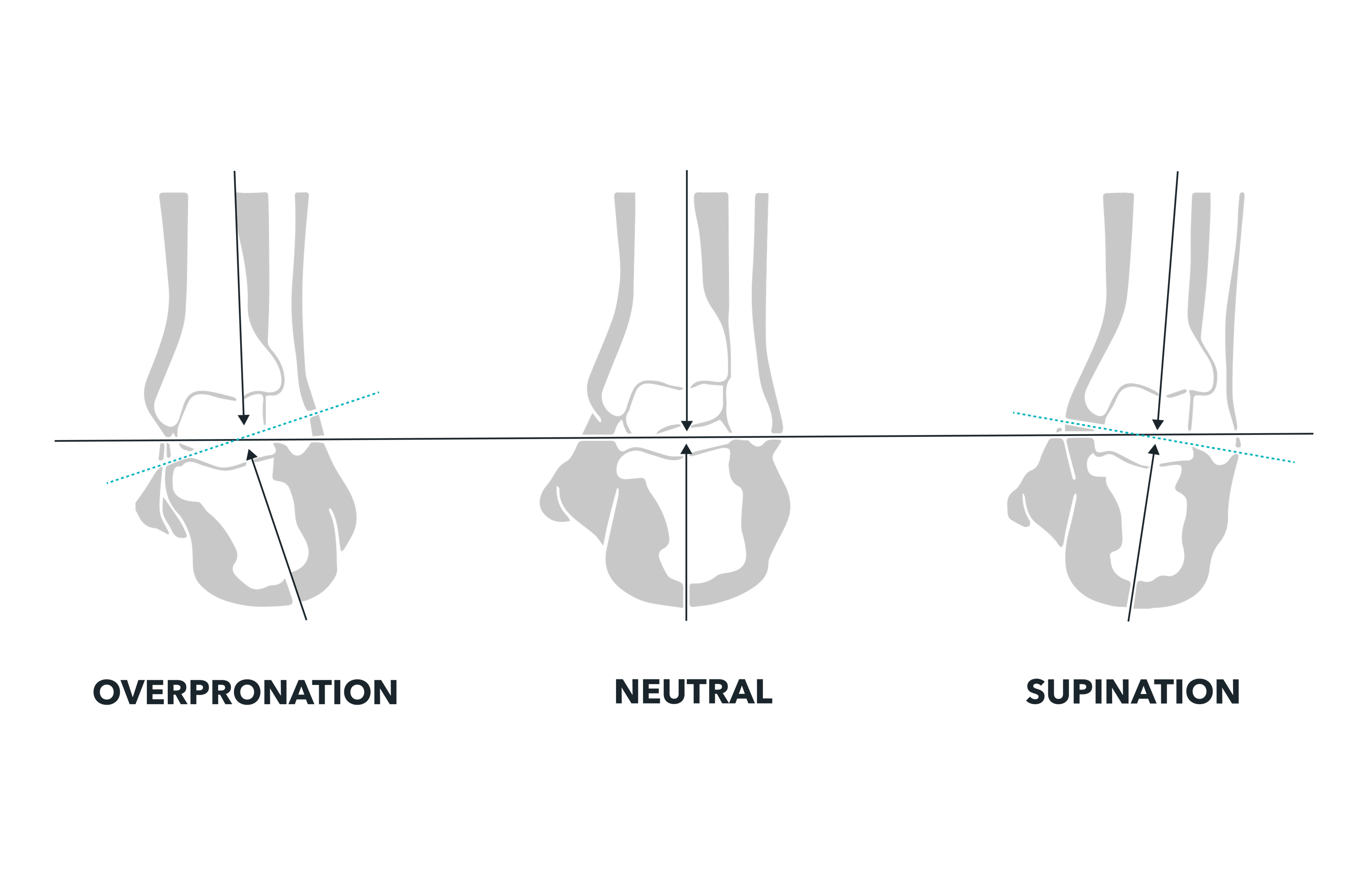 Gales Becomes The First Ever HSA/FSA Eligible Footwear