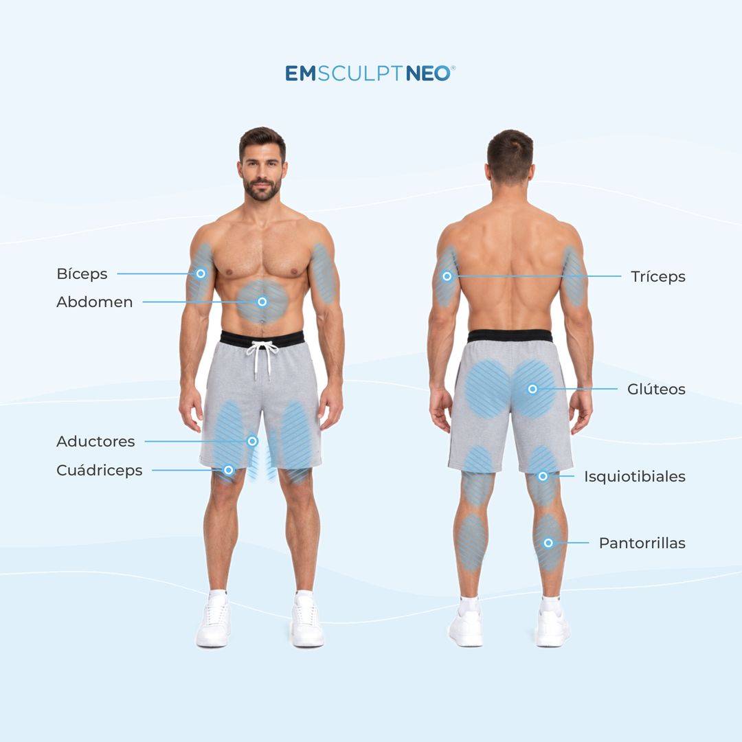 Zonas de tratamiento de Emsculpt NEO en hombre: bíceps, abdomen, aductores, cuádriceps, tríceps, glúteos, isquiotibiales y pantorrillas