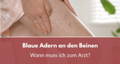 blaue adern an den beinen