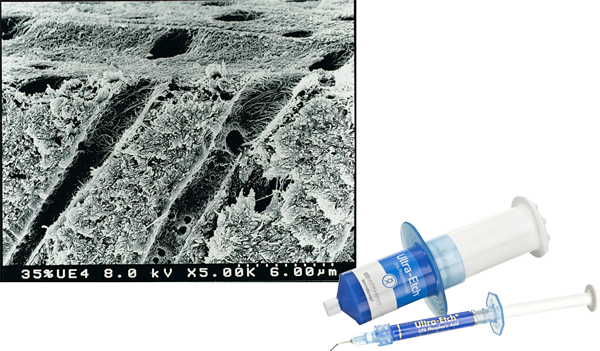 Ultra-Etch FE SEM Self Limiting Image