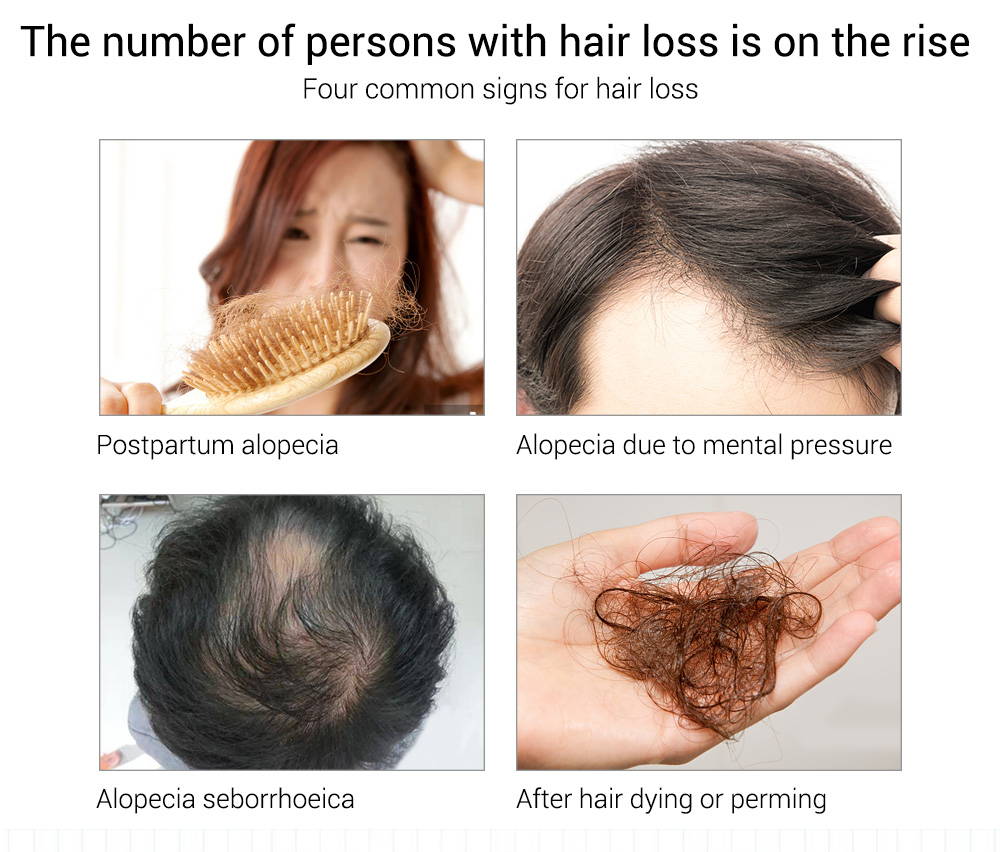 Hair Growth Essential Oil – LANBENA