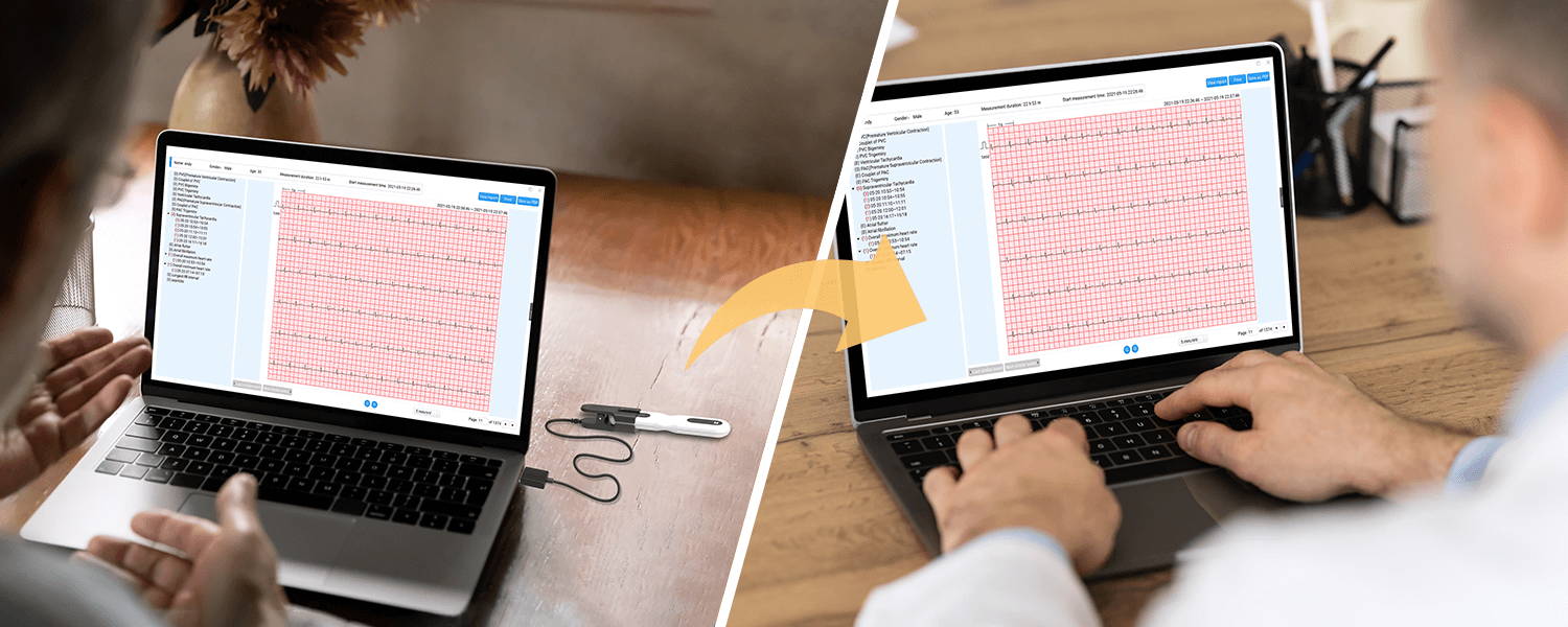 share ecg report with healthcare professionals