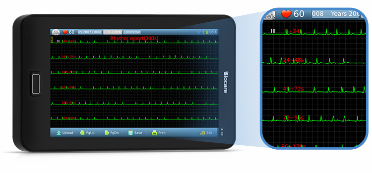 up to 300 seconds ECG rhythms can be captured and analyzed