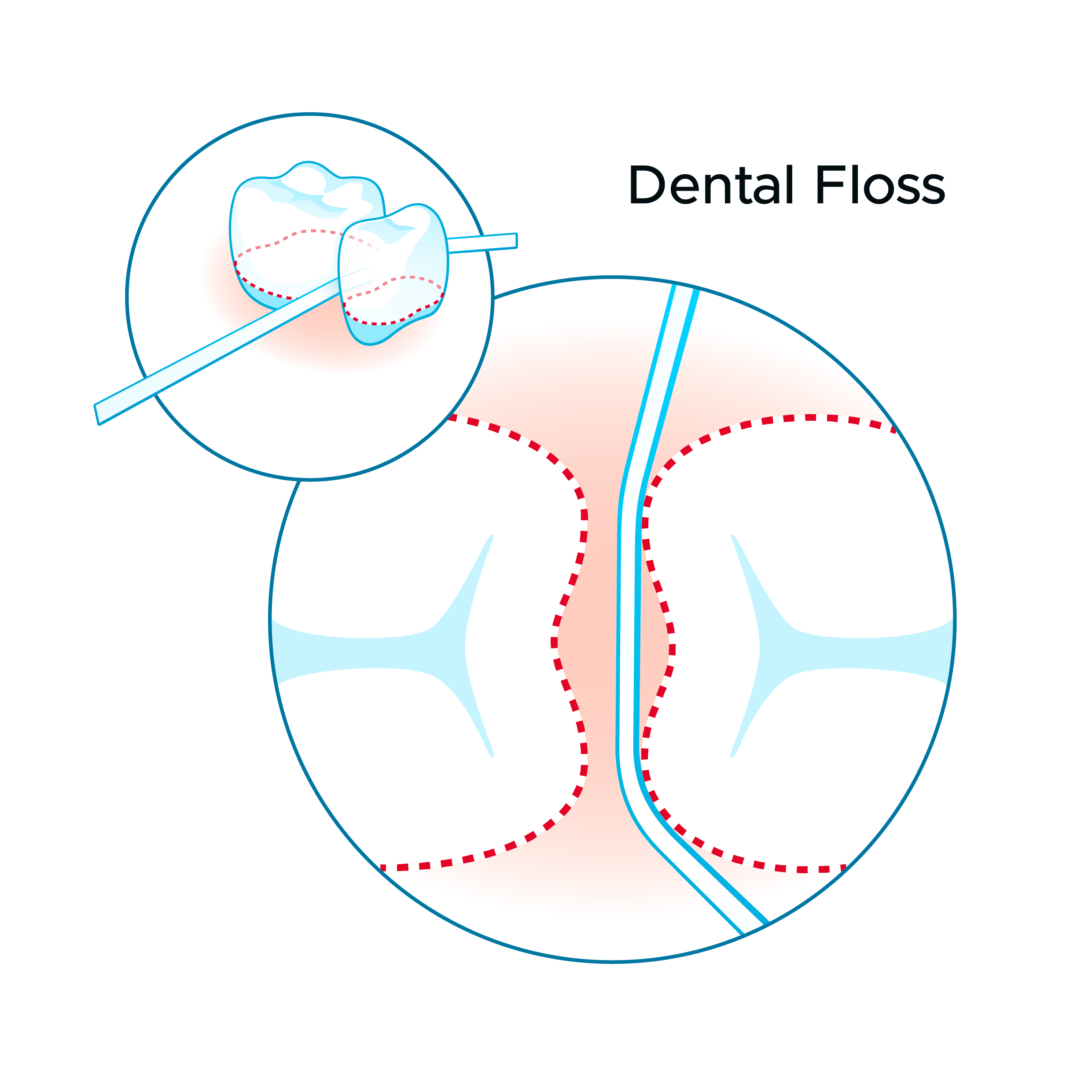 illustration showing floss performance between teeth